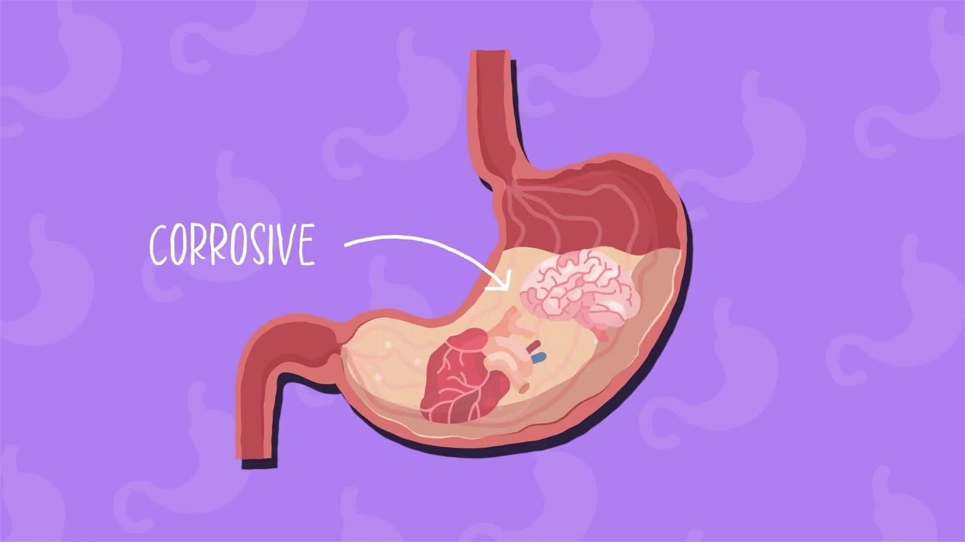 I WONDER - What Is Stomach Acid?