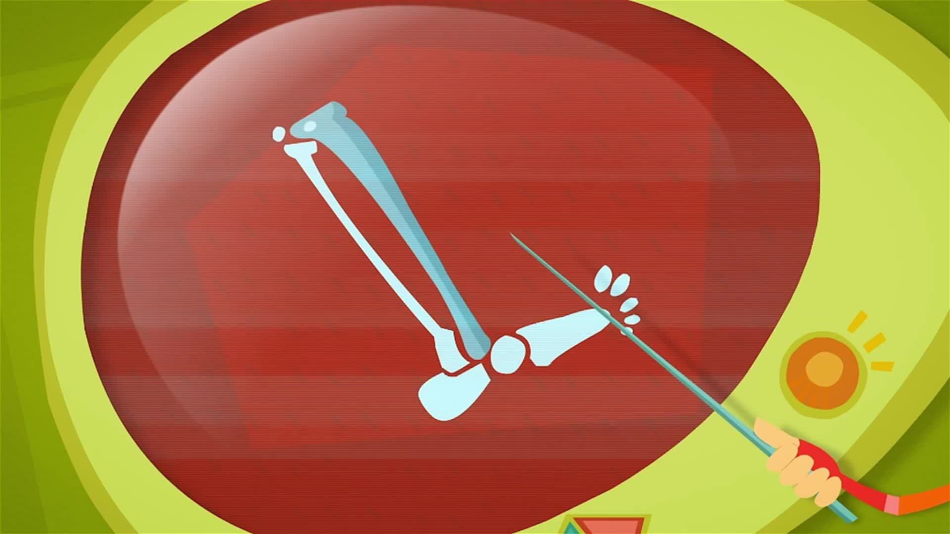 The Prosthesis