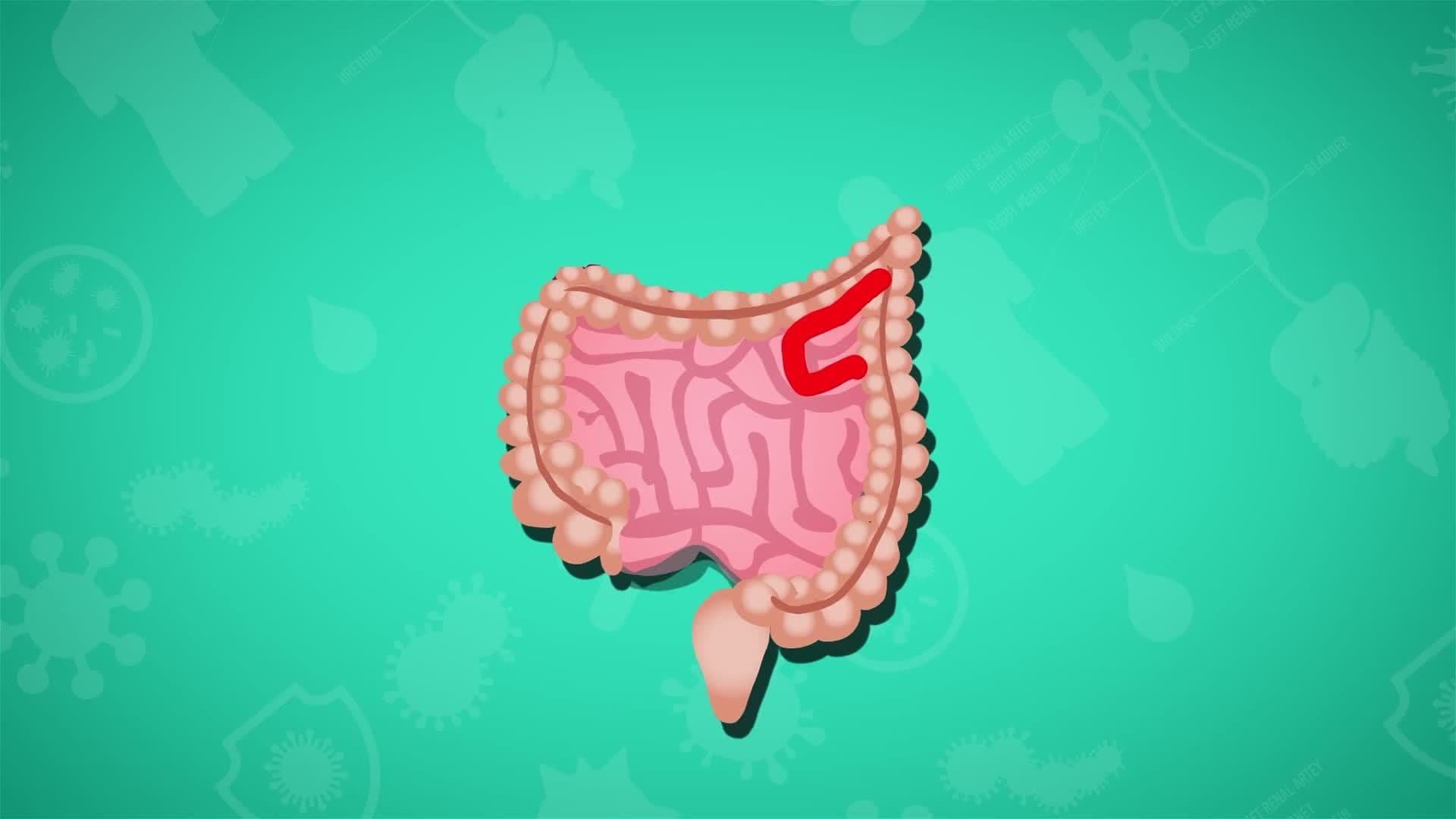 I WONDER - Are There Different Parts To The Intestine?