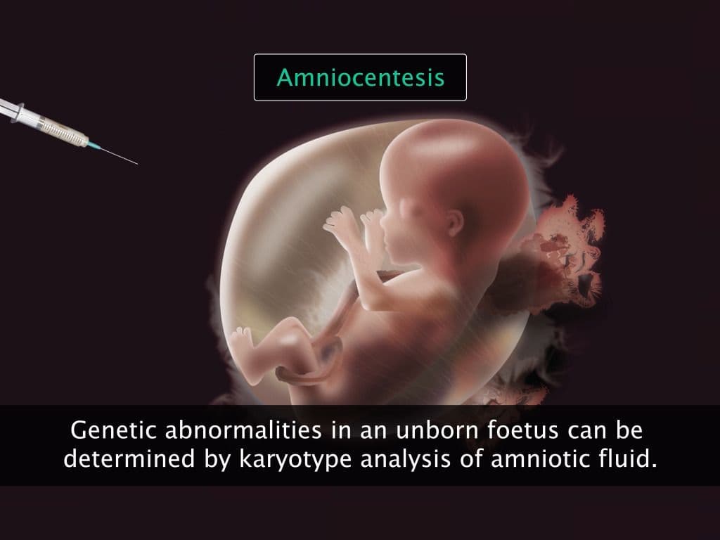 Chromosomes