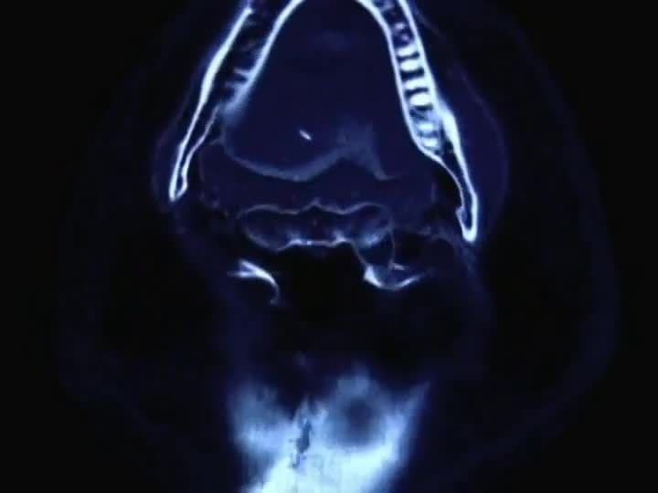 Virtual Archaeology: How Computer Tomography Changed Archaeology